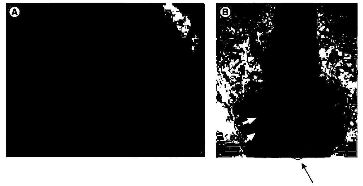 Preparation method of cell suspension for promoting hair regeneration and preventing alopecia