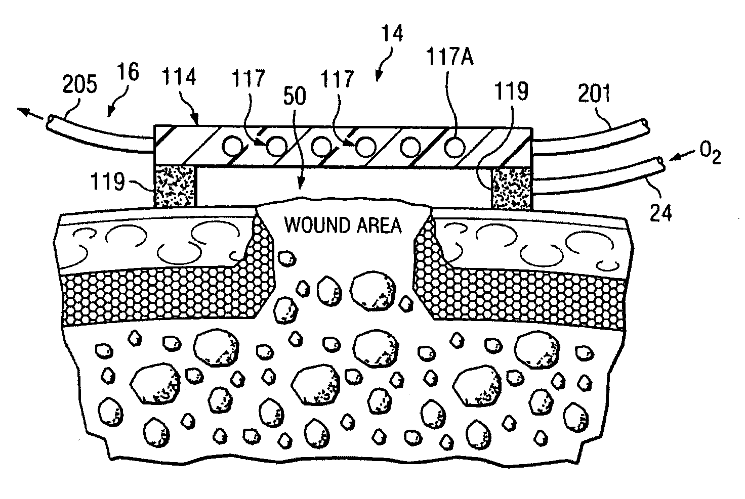 Wound care method and system with one or both of vacuum-light therapy and thermally augmented oxygenation