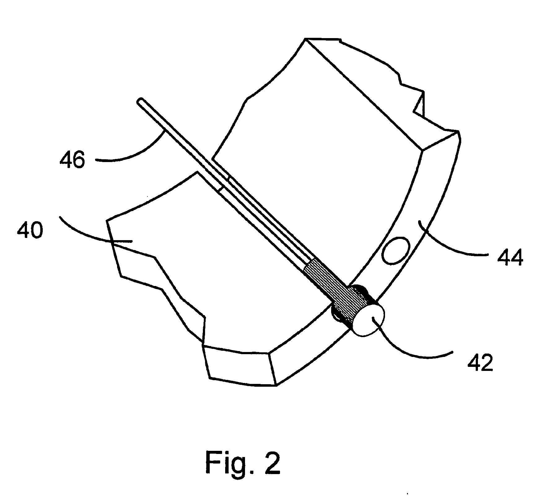 Tube for inspecting internal organs of a body