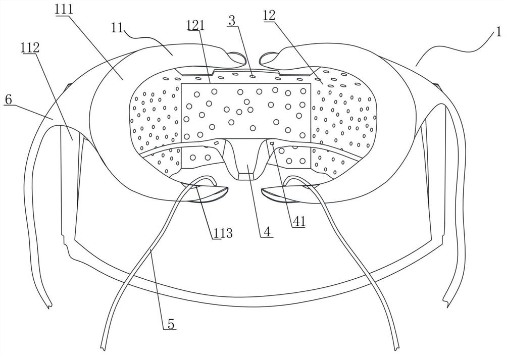 A negative pressure mouthpiece for preventing aerosol spreading in stomatology