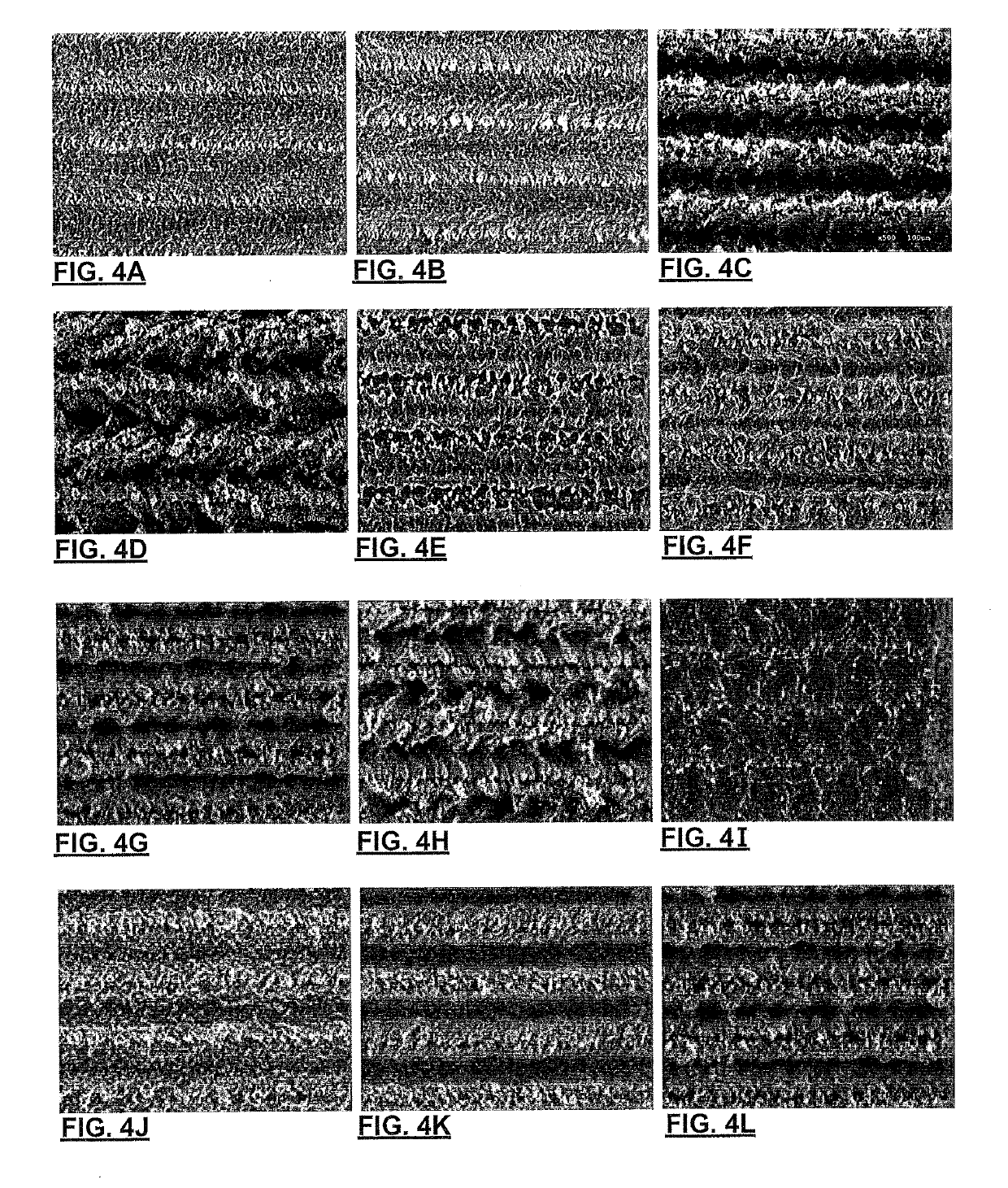 Metallic surface with karstified relief, forming same, and high surface area metallic electrochemical interface