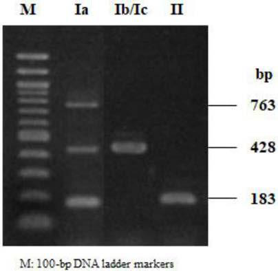 Primer set and kit for detecting serotype of streptococcus parauberis