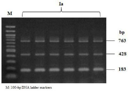 Primer set and kit for detecting serotype of streptococcus parauberis