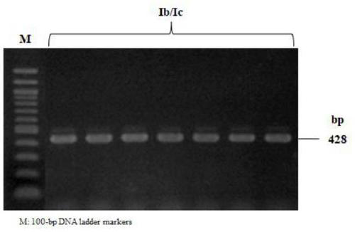 Primer set and kit for detecting serotype of streptococcus parauberis