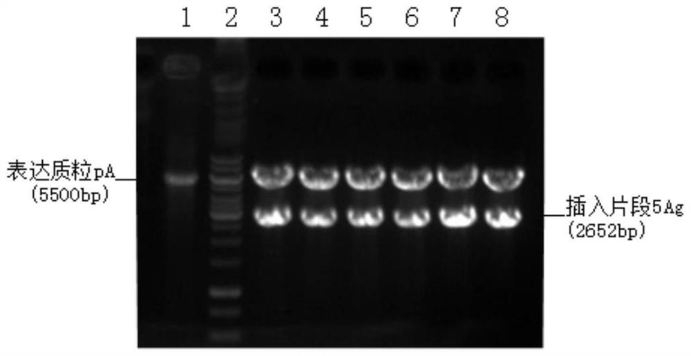 A recombinant tuberculosis vaccine, its preparation method and application