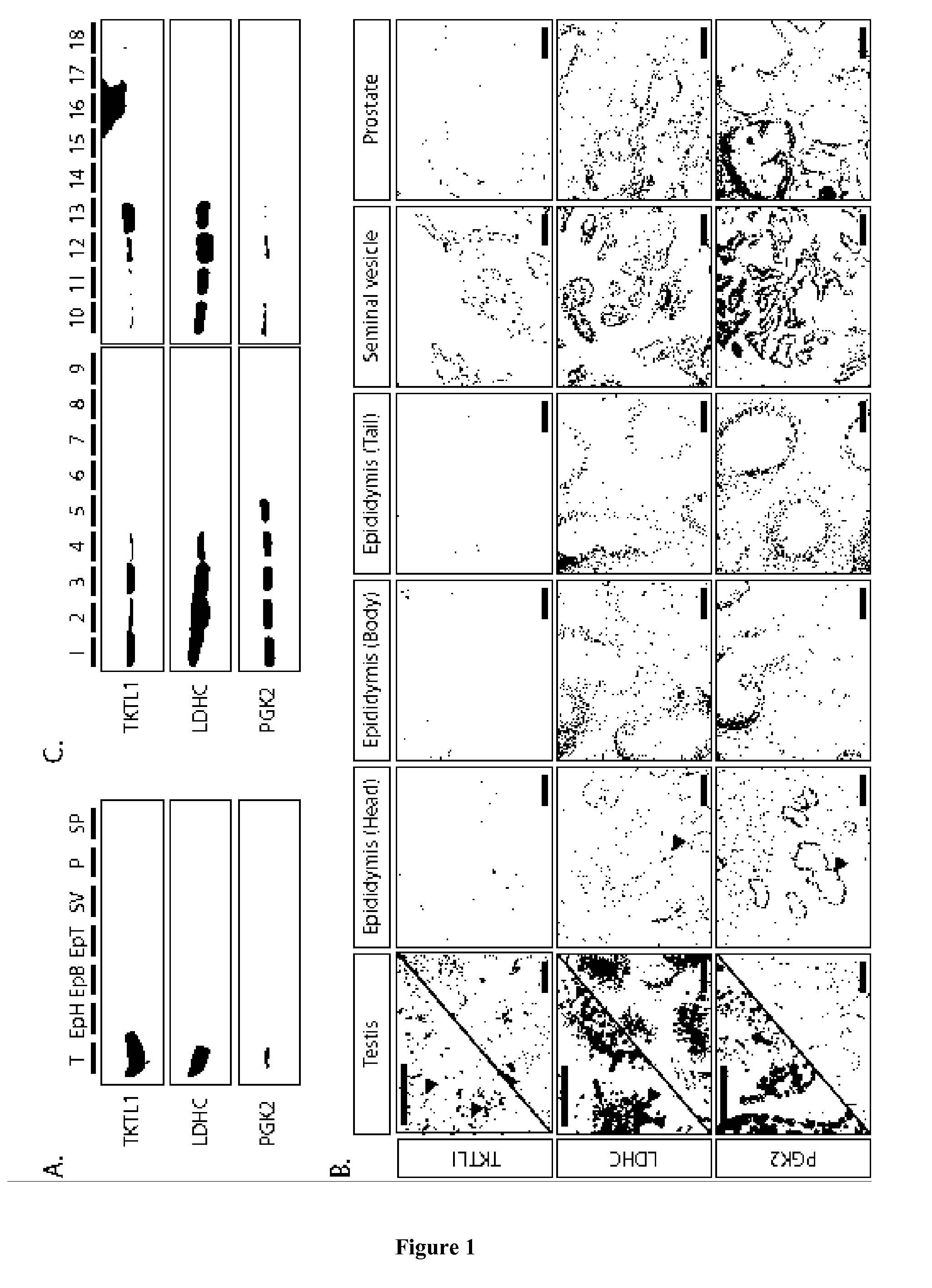 Method for predicting the presence of reproductive cells in testis