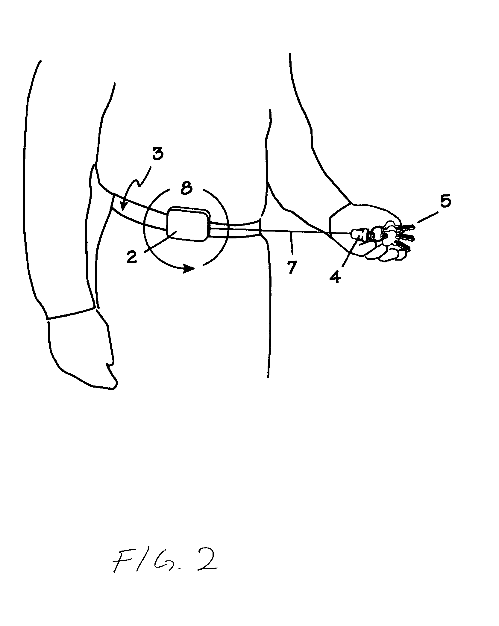 Rotatable retracting apparatus