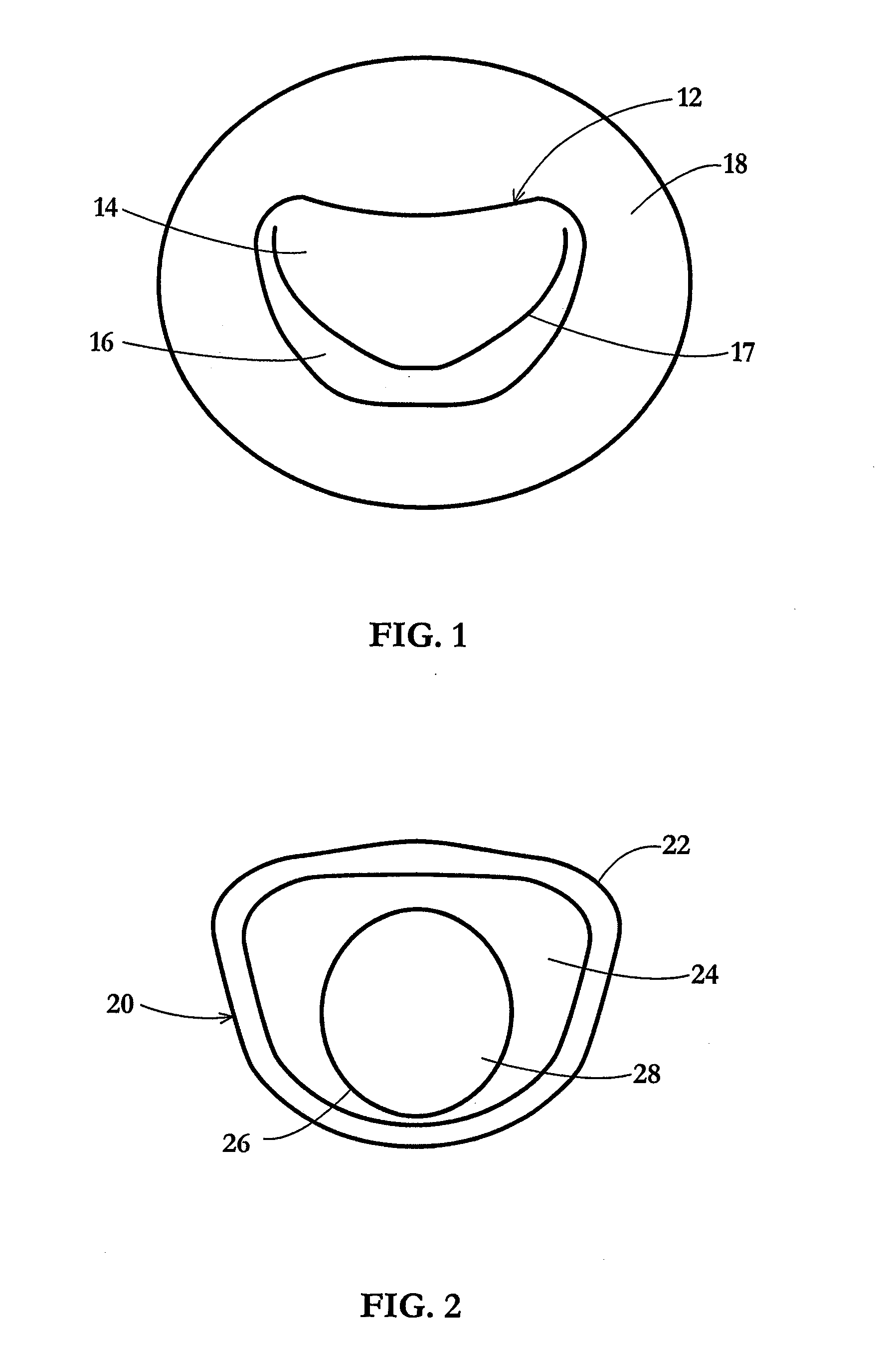 Device and method for temporary or permanent suspension of an implantable scaffolding containing an orifice for placement of a prosthetic or bio-prosthetic valve