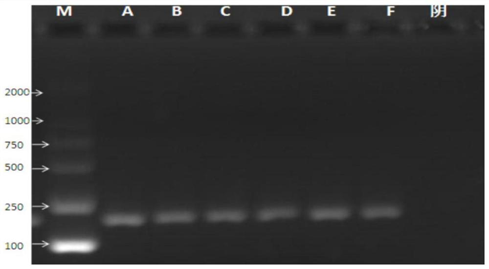 A kit for detecting pneumococcal serotype 10a