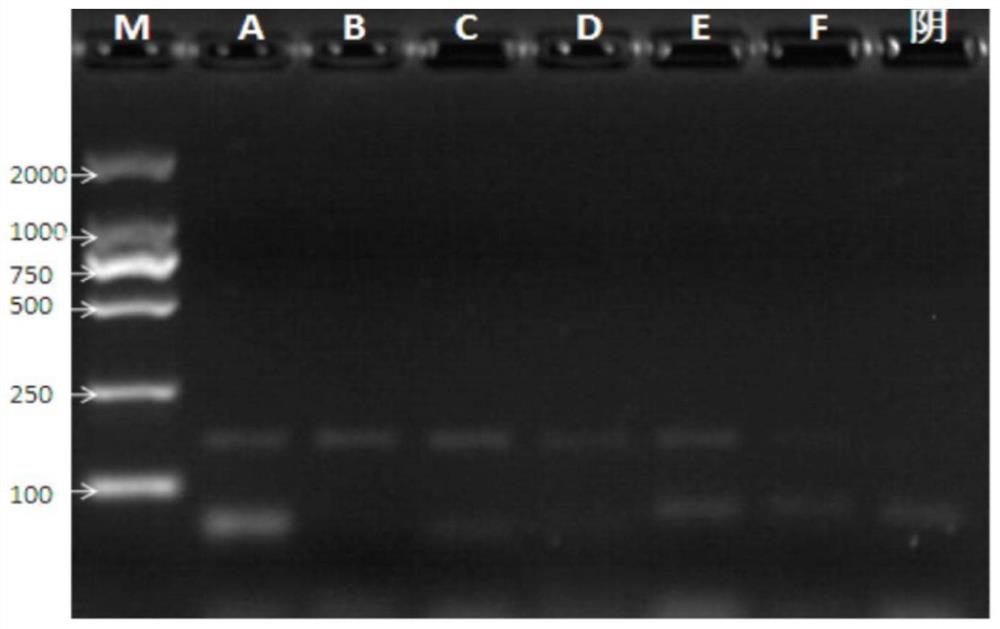 A kit for detecting pneumococcal serotype 10a