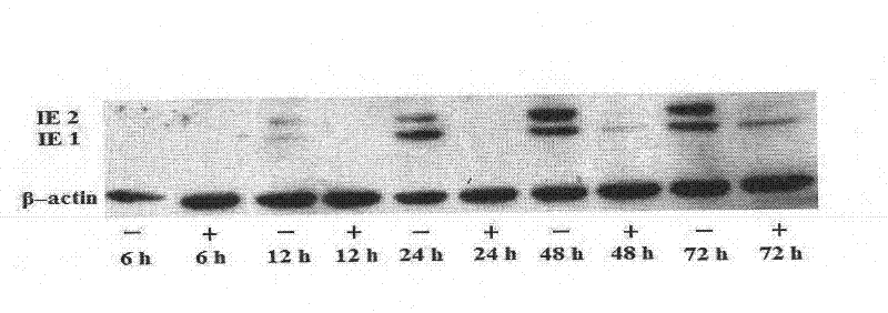 Notoginseng extract and application thereof