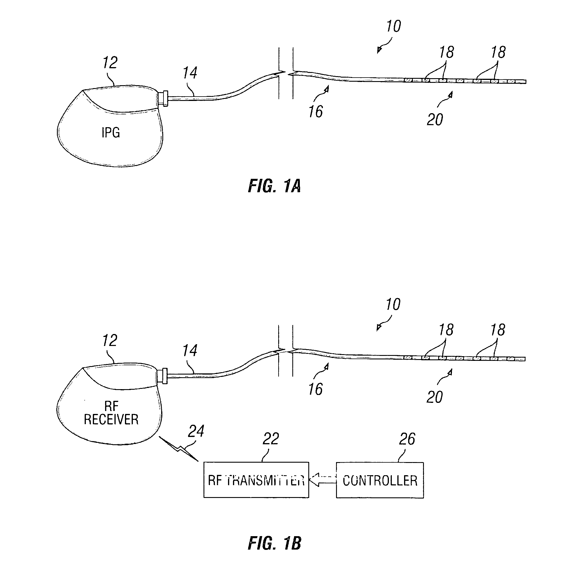 Stimulation system and method for treating a neurological disorder