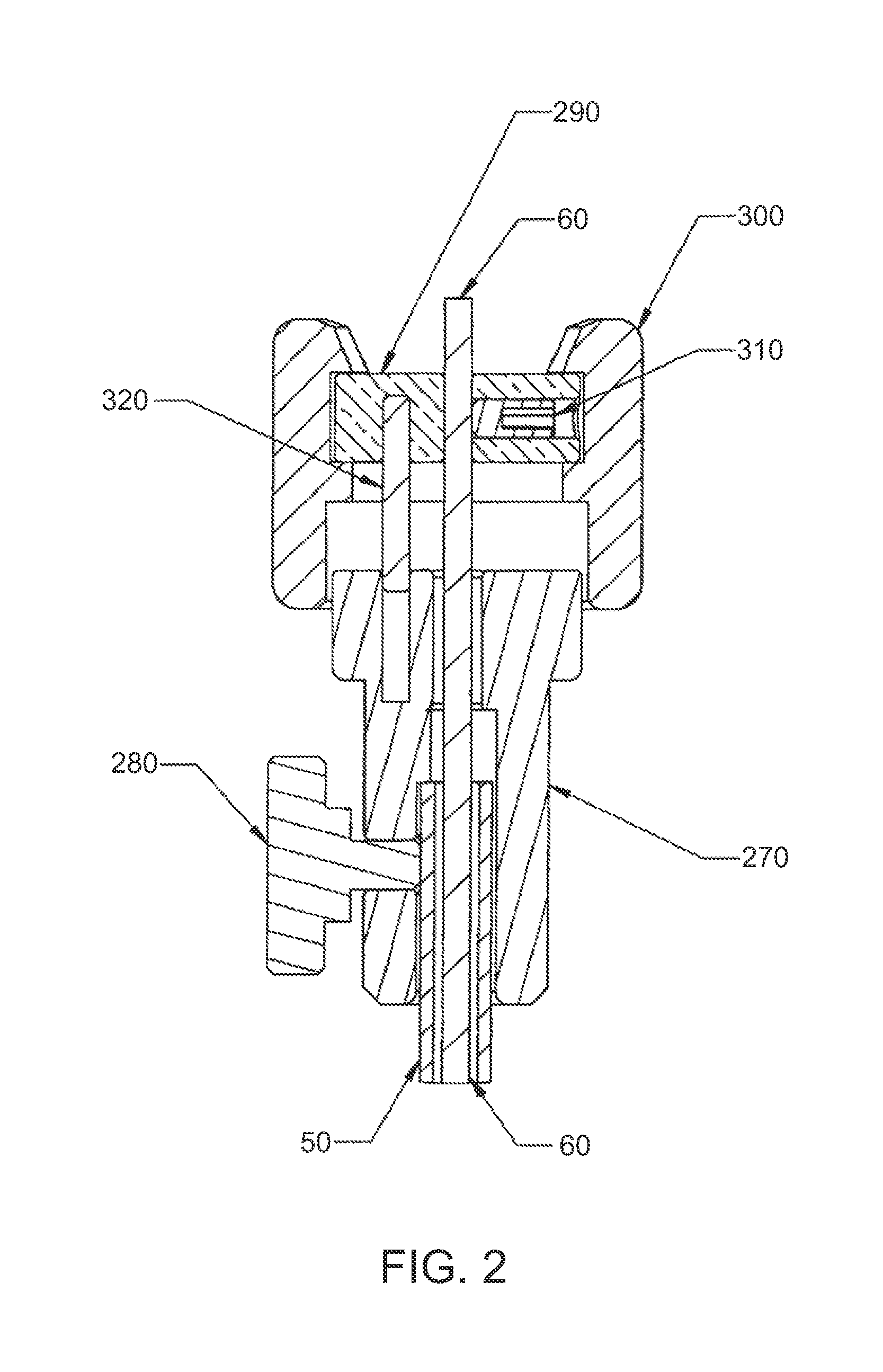 Luminal structure anchoring devices and methods