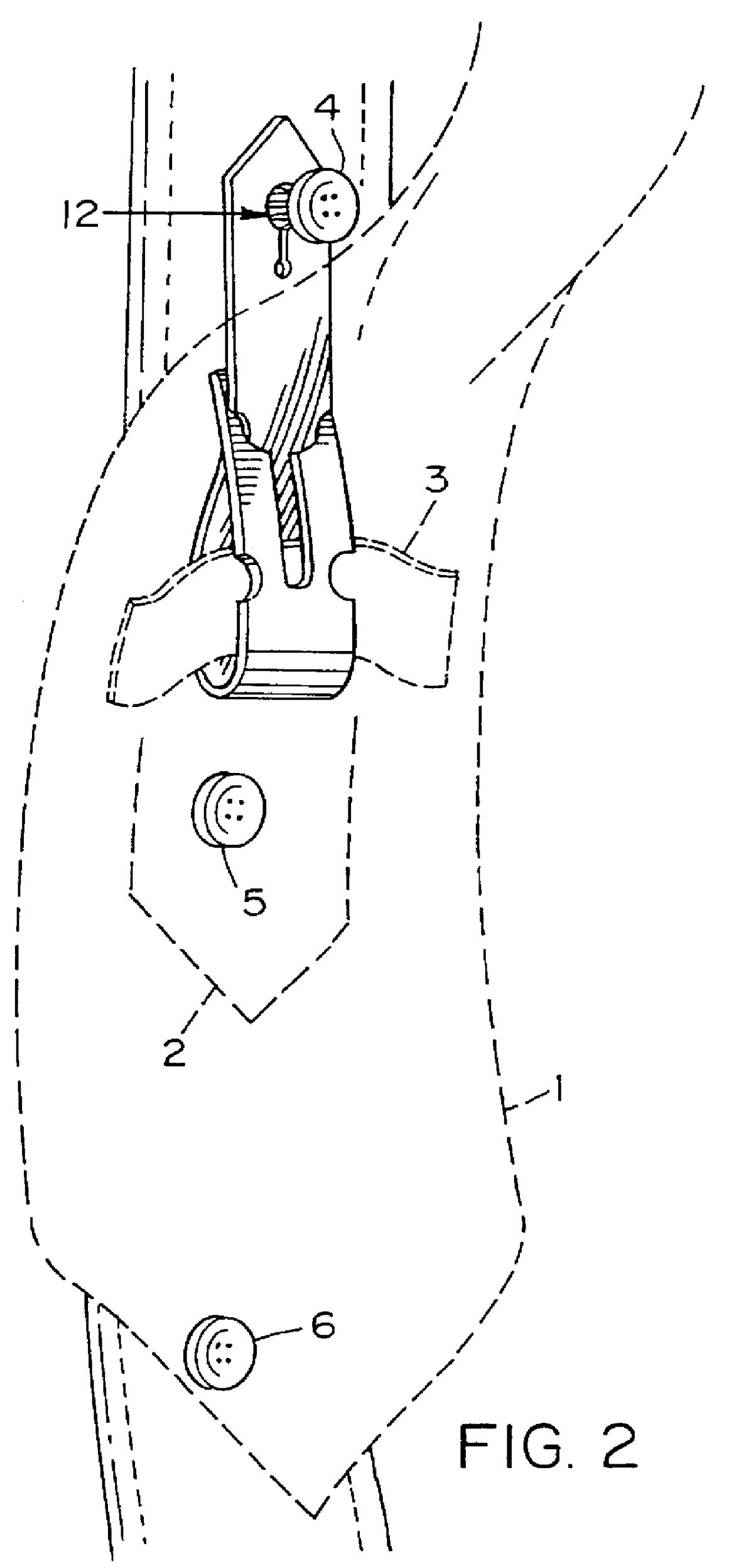 Simplified tie restraint