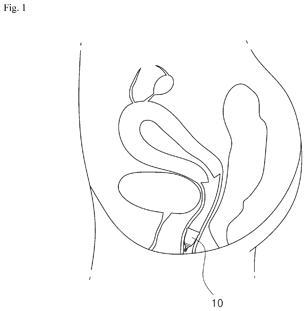 Easily inserted menstrual cup