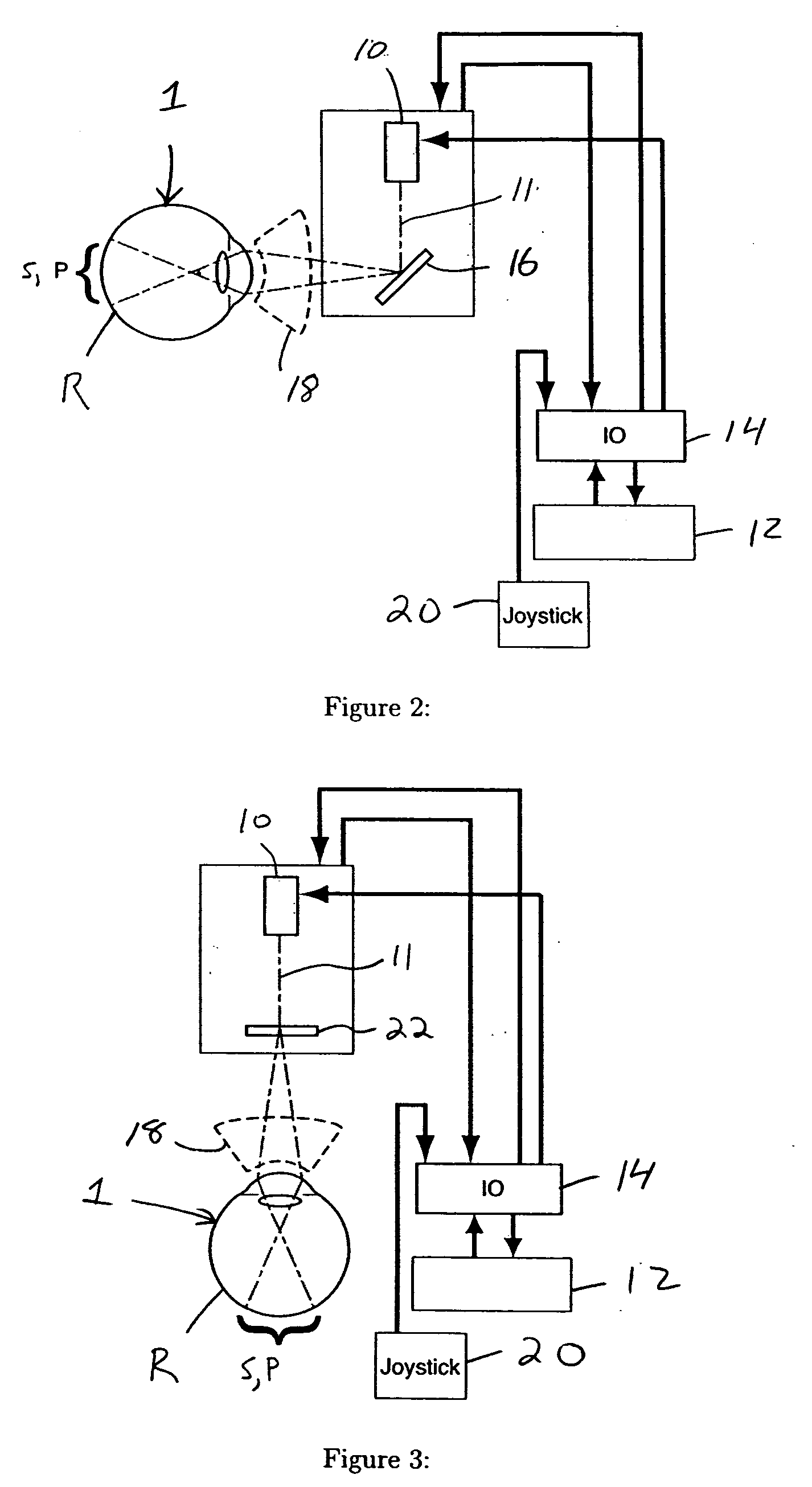 Scanning ophthalmic fixation method and apparatus