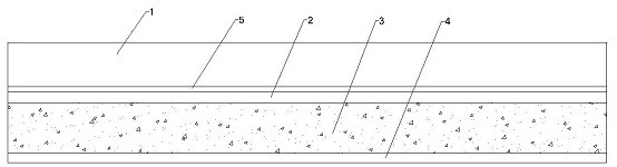 Anesthesia dressing and preparation method thereof