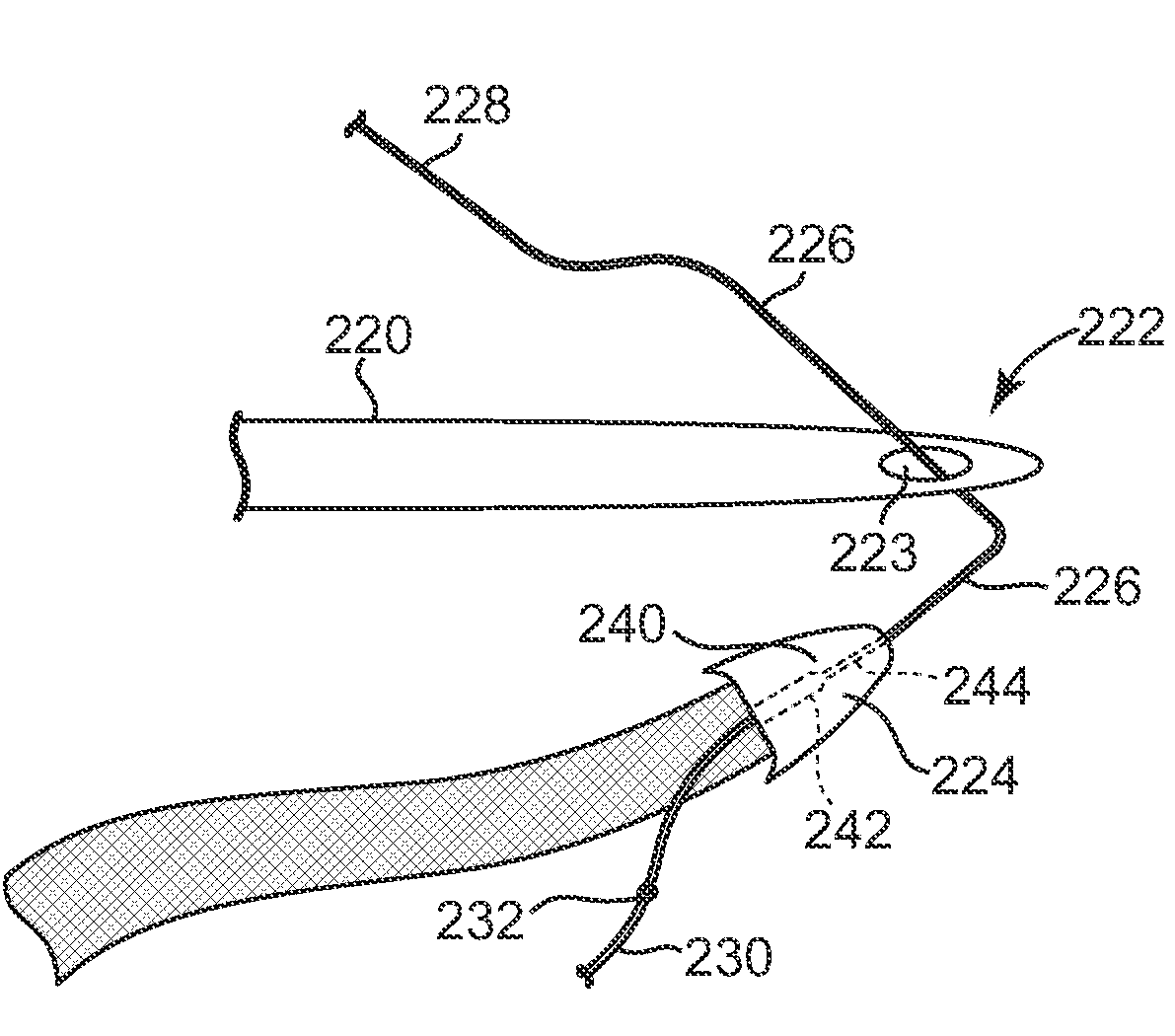 Surgical Articles and Methods for Treating Pelvic Conditions