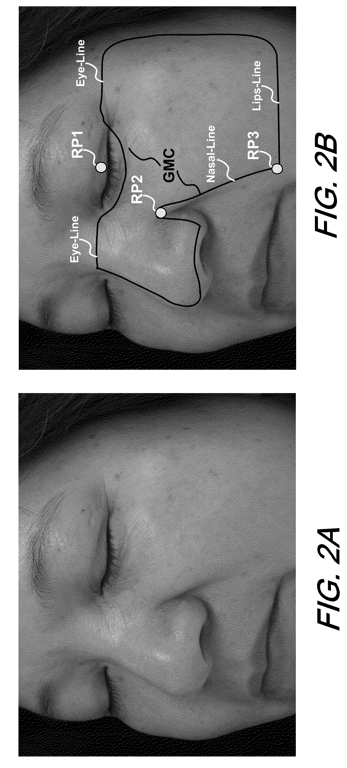 Automatic mask design and registration and feature detection for computer-aided skin analysis