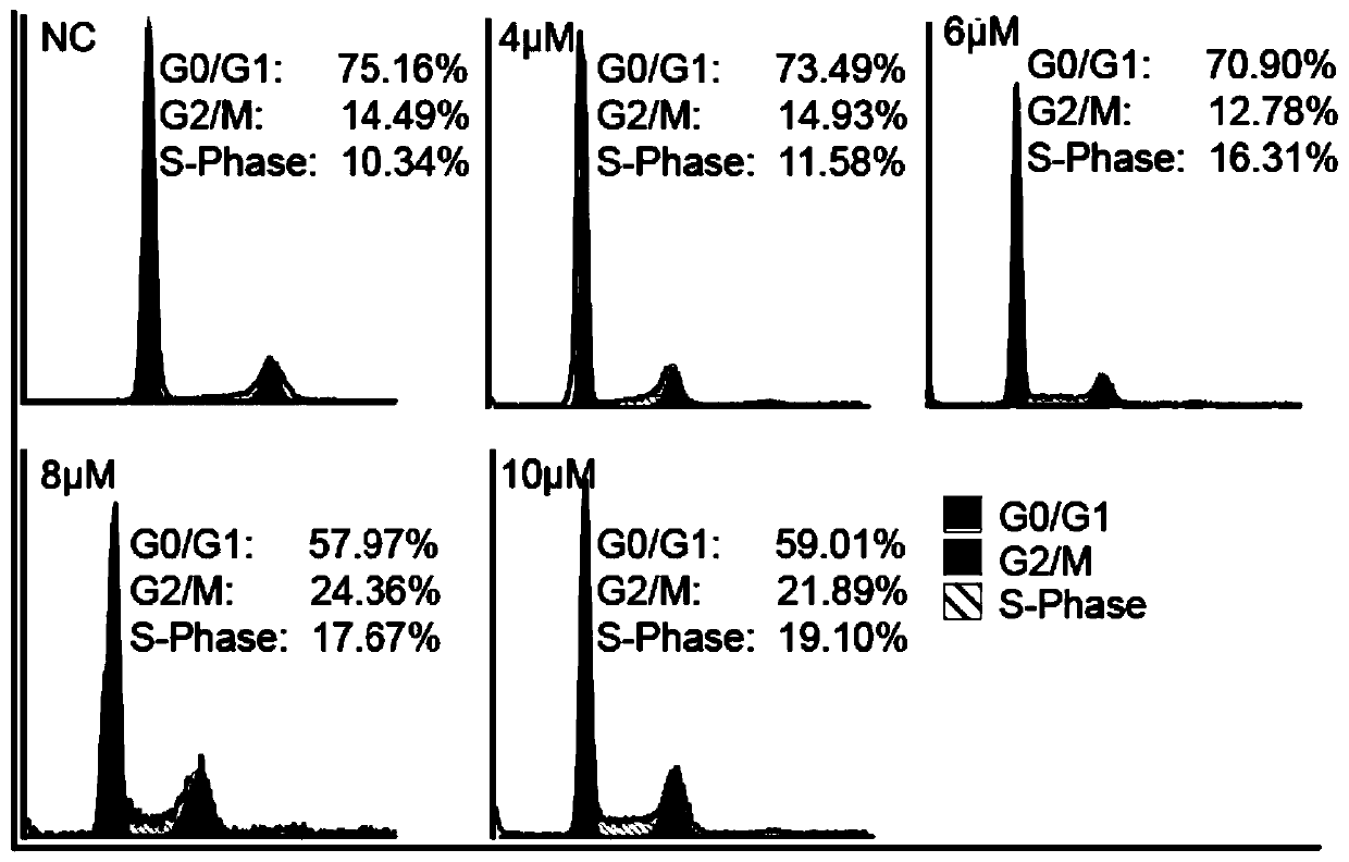 Fat synthetase inhibitor and applications thereof