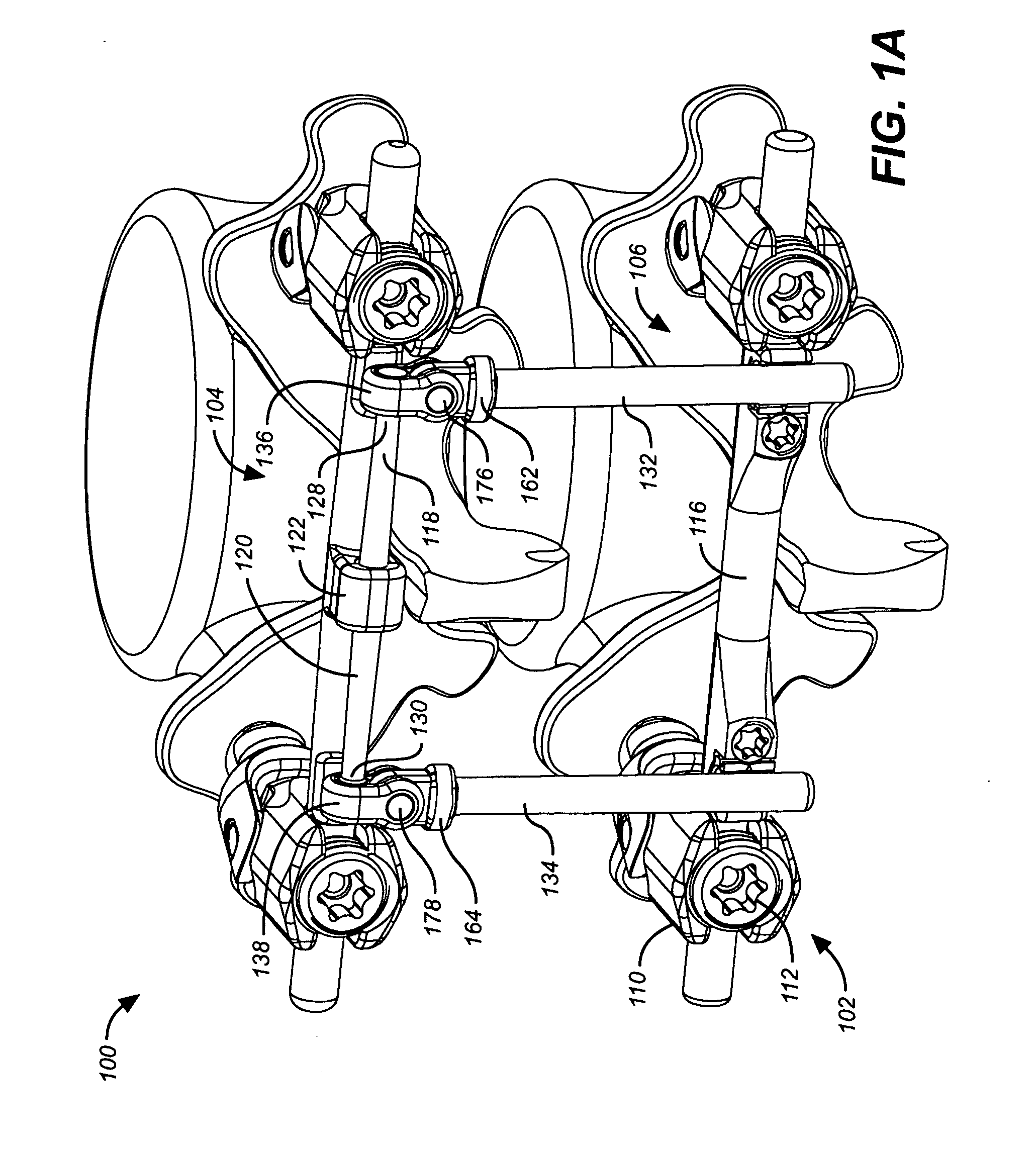 Deflection rod system for spine implant with end connectors and method