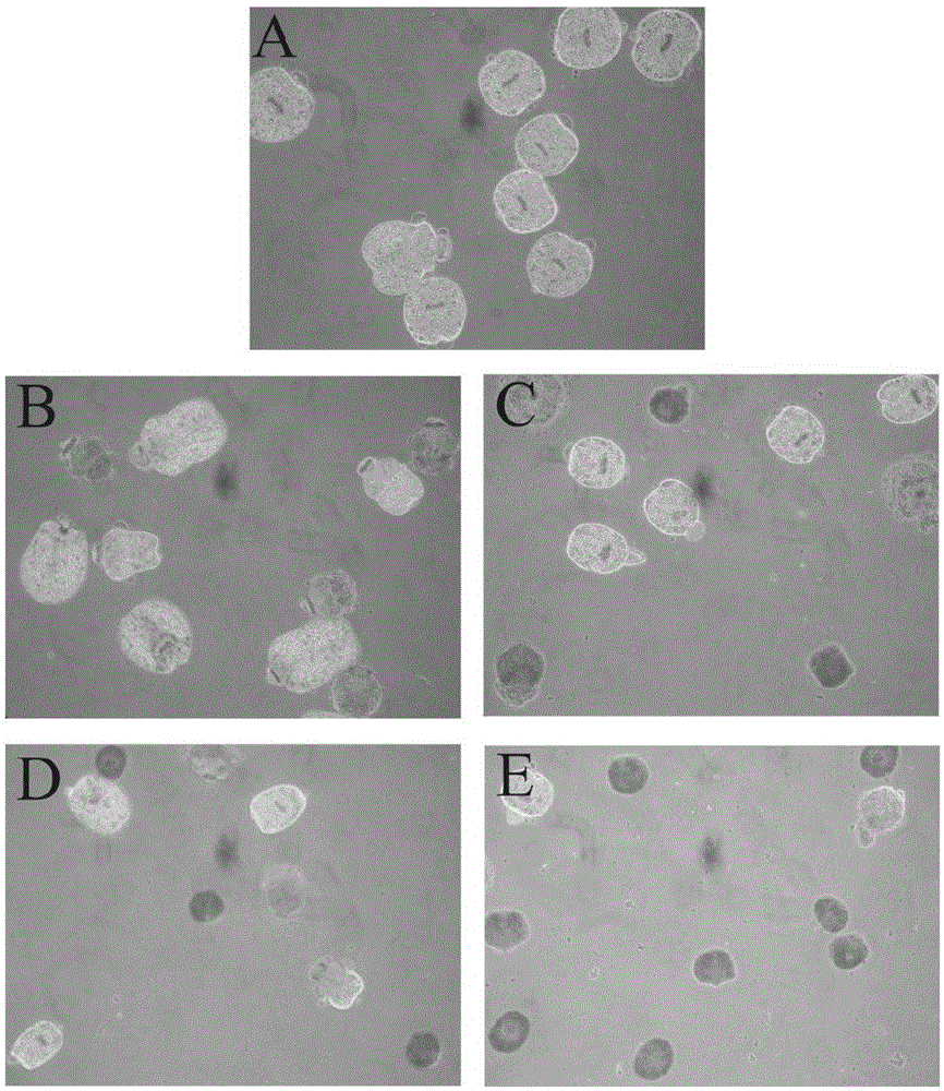 Application of lithocholic acid serving as active ingredient in preparation of echinococcosis granulosis cyst treatment medicine