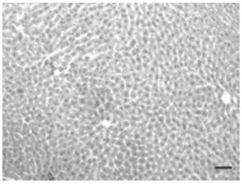 Application of lycium barbarum polysaccharide in preparation of drugs for reducing blood ammonia and drugs for treating hepatic encephalopathy