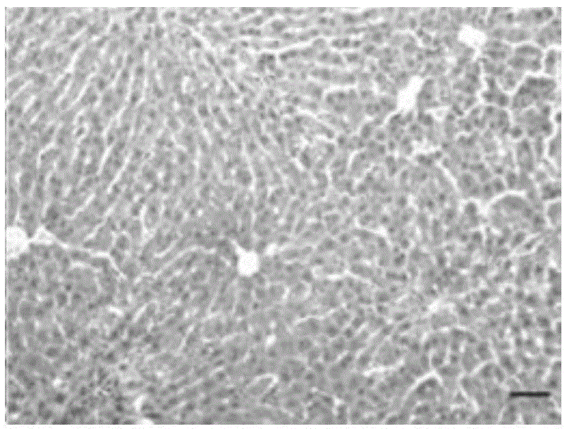 Application of lycium barbarum polysaccharide in preparation of drugs for reducing blood ammonia and drugs for treating hepatic encephalopathy