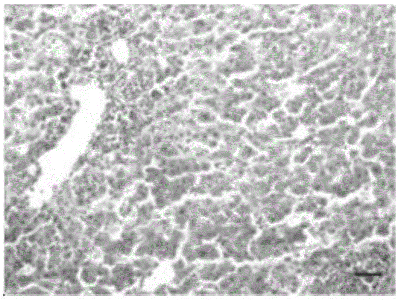 Application of lycium barbarum polysaccharide in preparation of drugs for reducing blood ammonia and drugs for treating hepatic encephalopathy