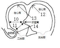 Interatrial septum puncture tool