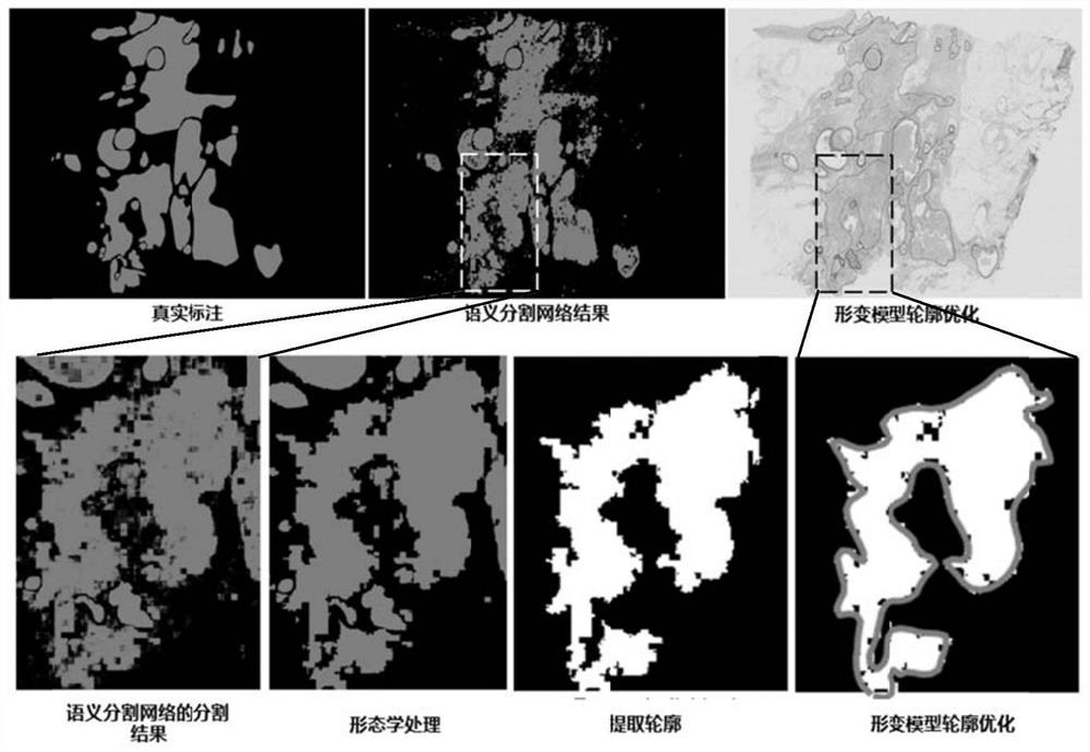 A method and system for automatic detection of lesions in pathological tissue slice images