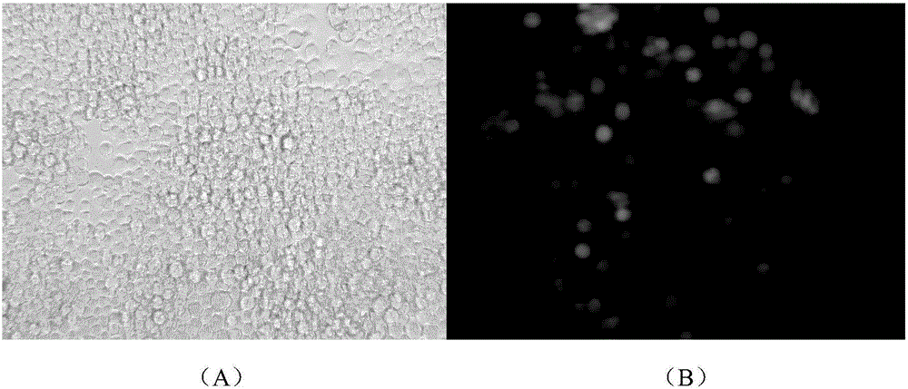 Baculovirus expression vector capable of quickly determining titer and construction and application thereof