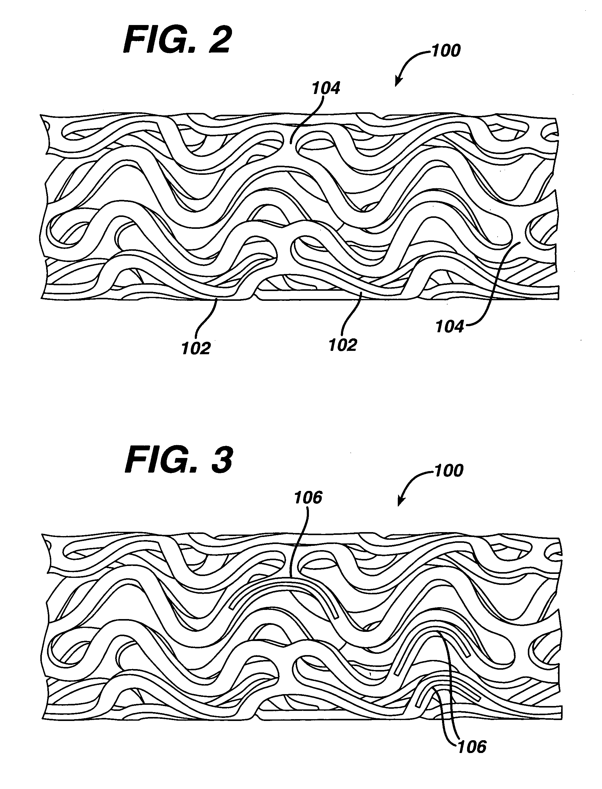 Drug/drug delivery systems for the prevention and treatment of vascular disease