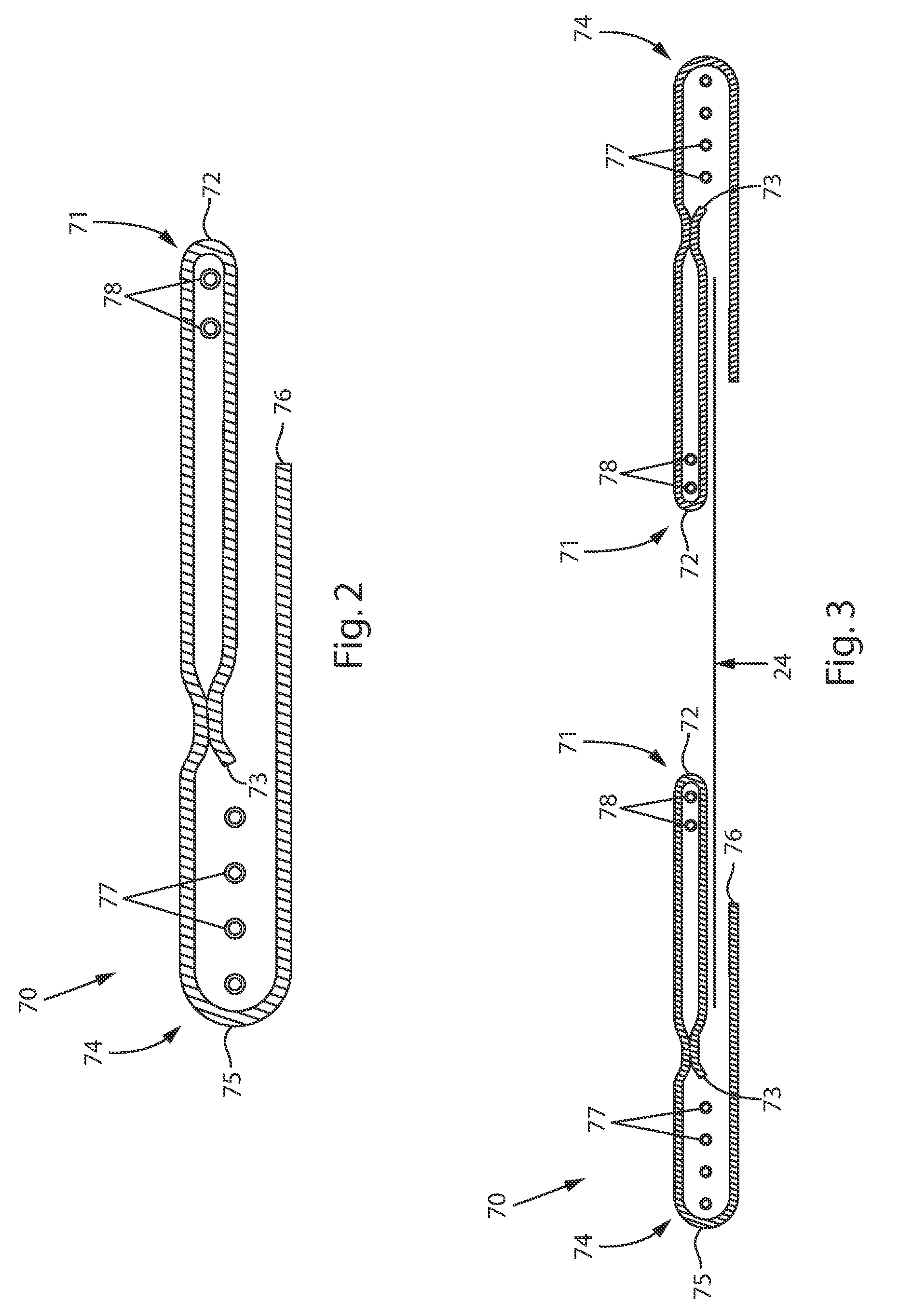 Absorbent Article With Narrow Polymeric Film And Opacity Strengthening Patch