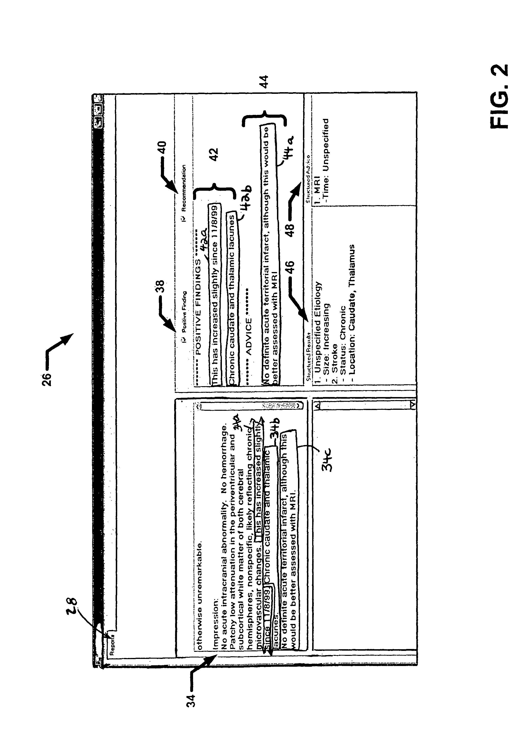 Information theory entropy reduction program