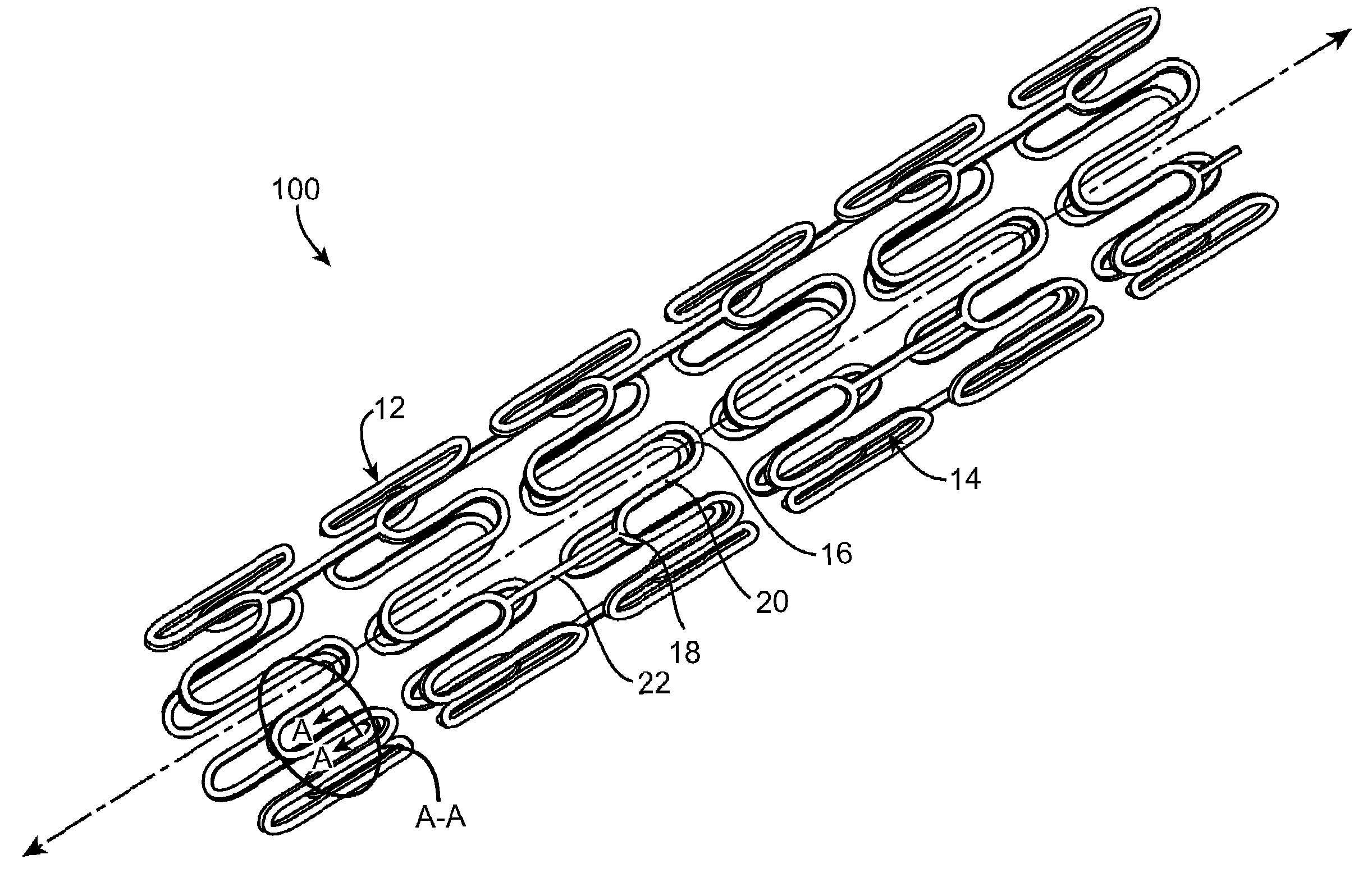 Bioresorbable Stent