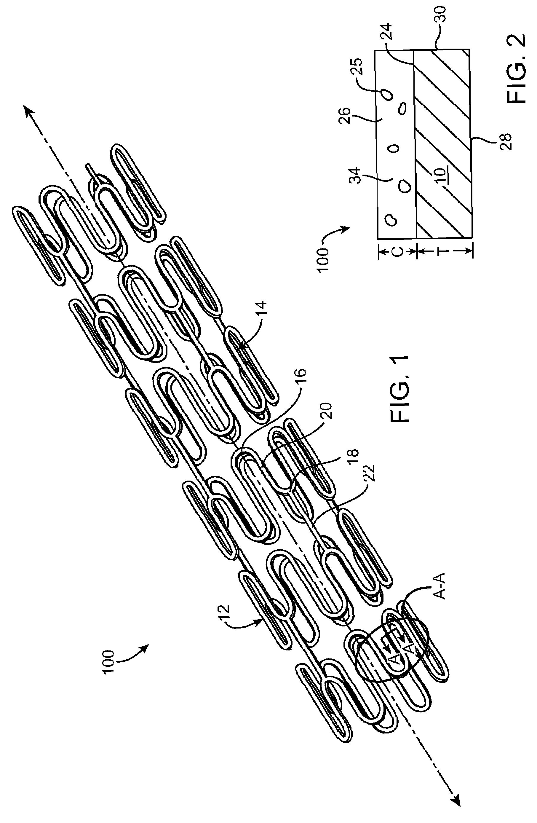 Bioresorbable Stent