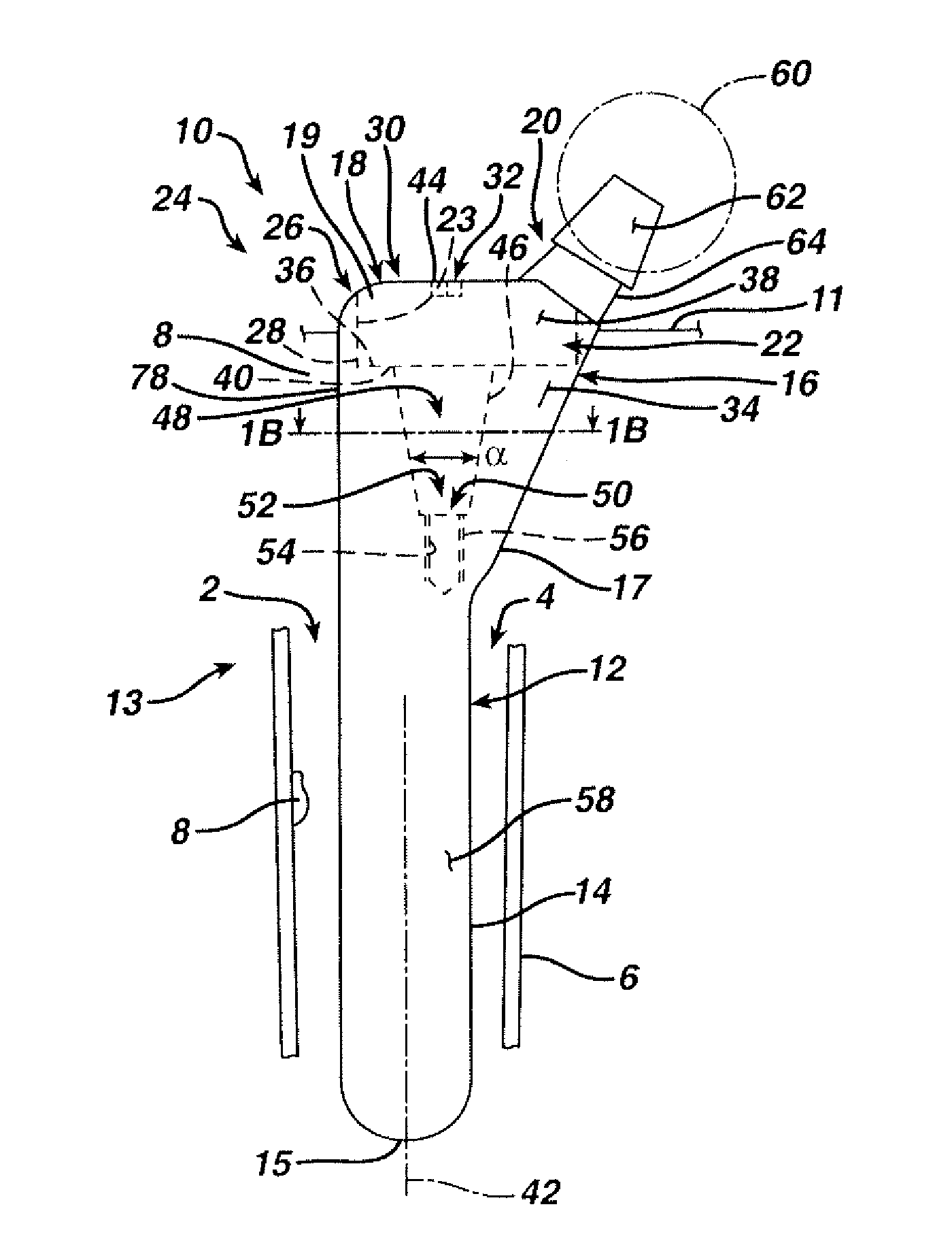 Orthopaedic implant kit, orthopaedic surgery kit and associated method