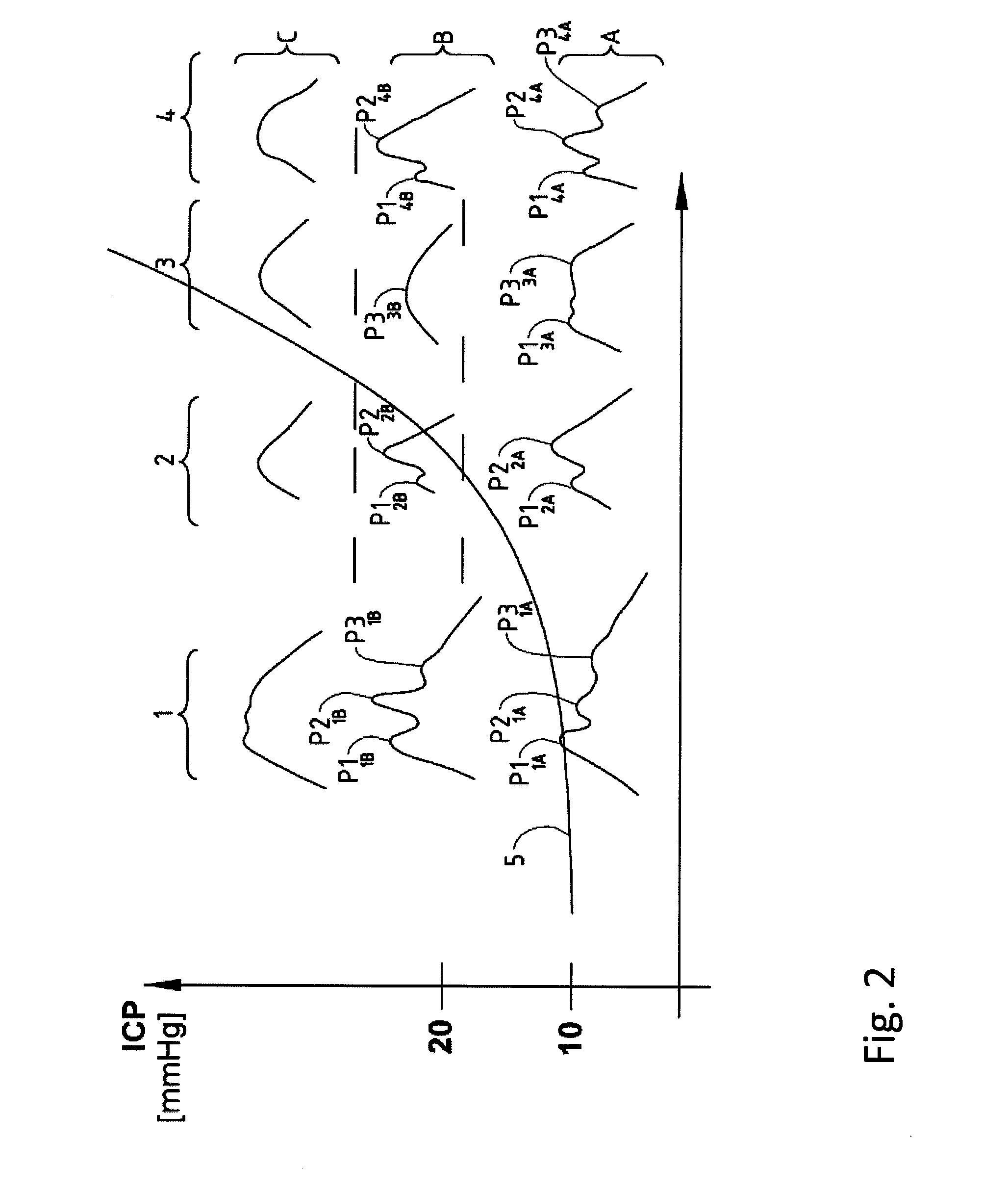 Measurement system and method for measuring parameters in a body tissue