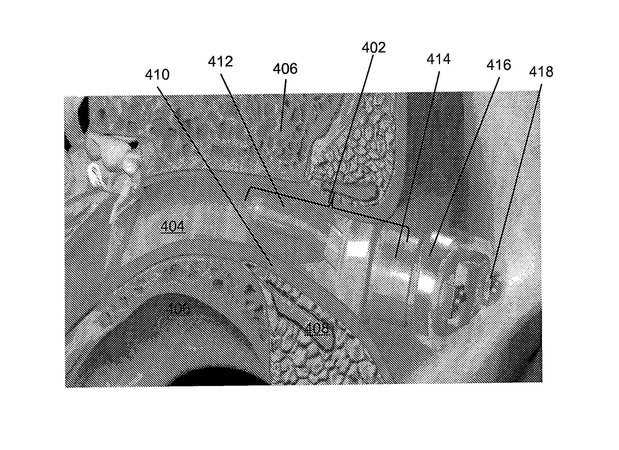 Method and device for acoustic sealing and occlusion effect mitigation