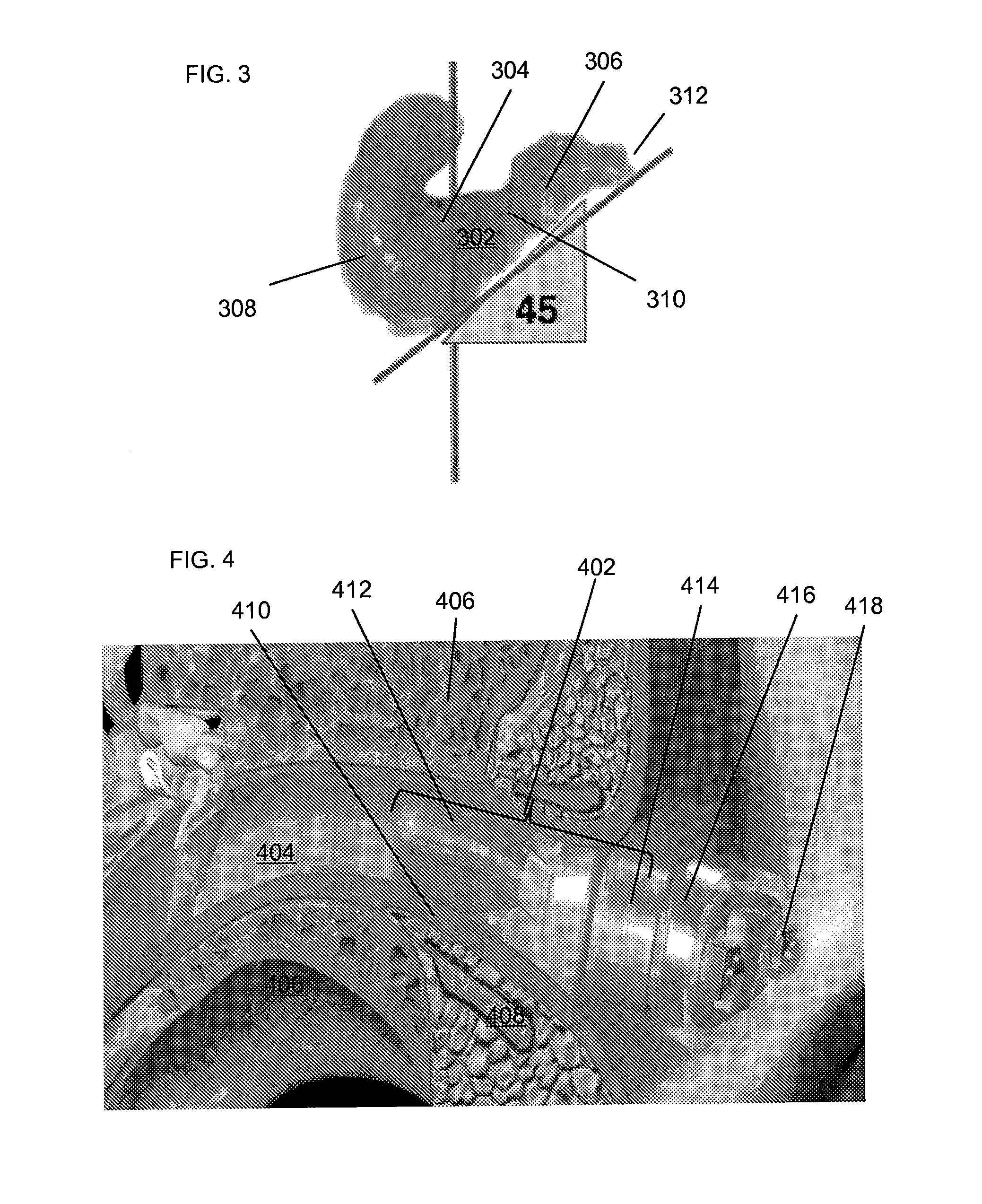 Method and device for acoustic sealing and occlusion effect mitigation