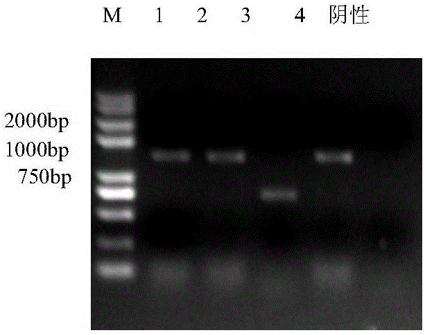 Porcine pseudorabies virus gene deletion attenuated vaccine strain for passage via low temperature of cell and attenuation via drug screening and application thereof