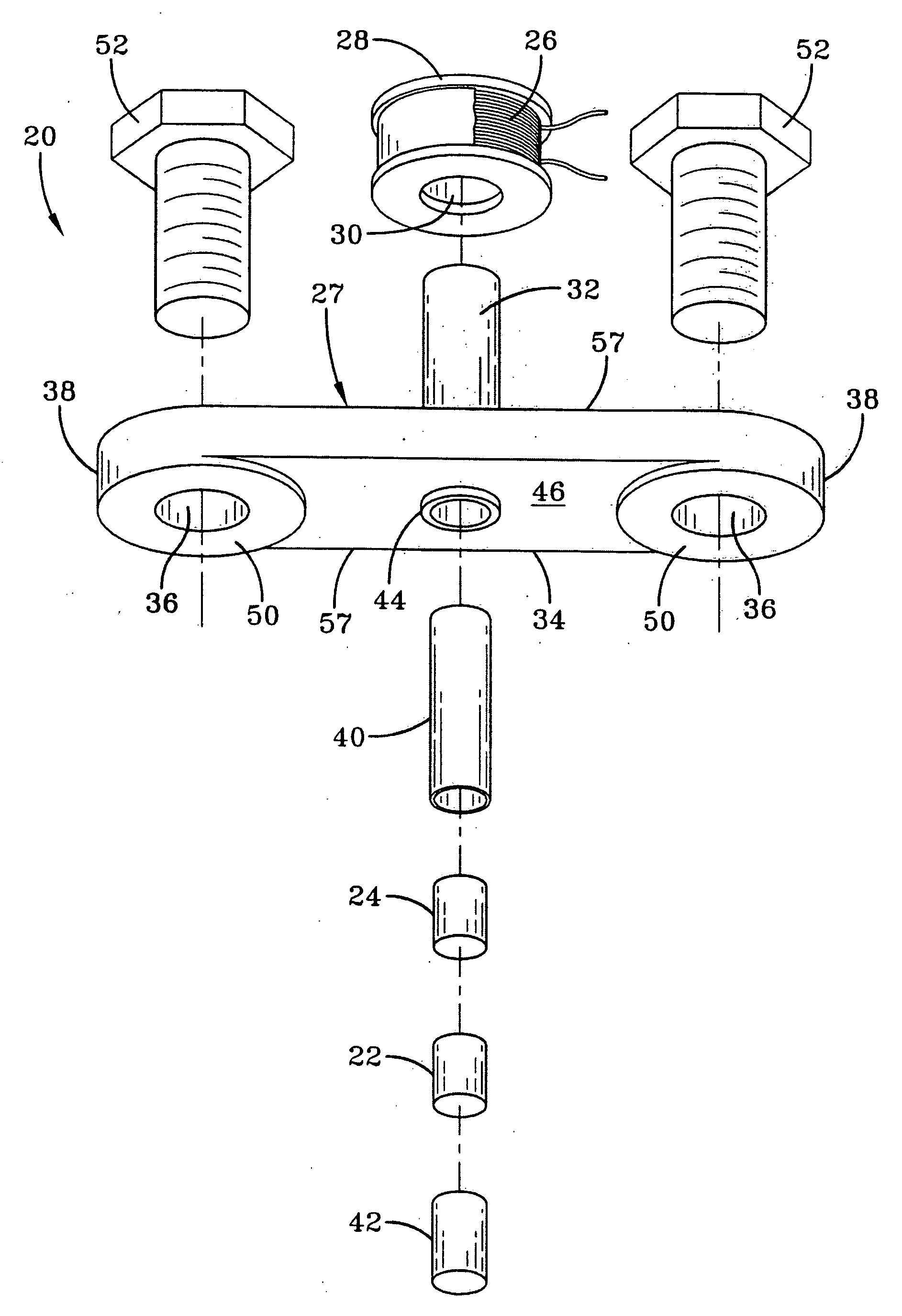 Magnetostrictive stress wave sensor