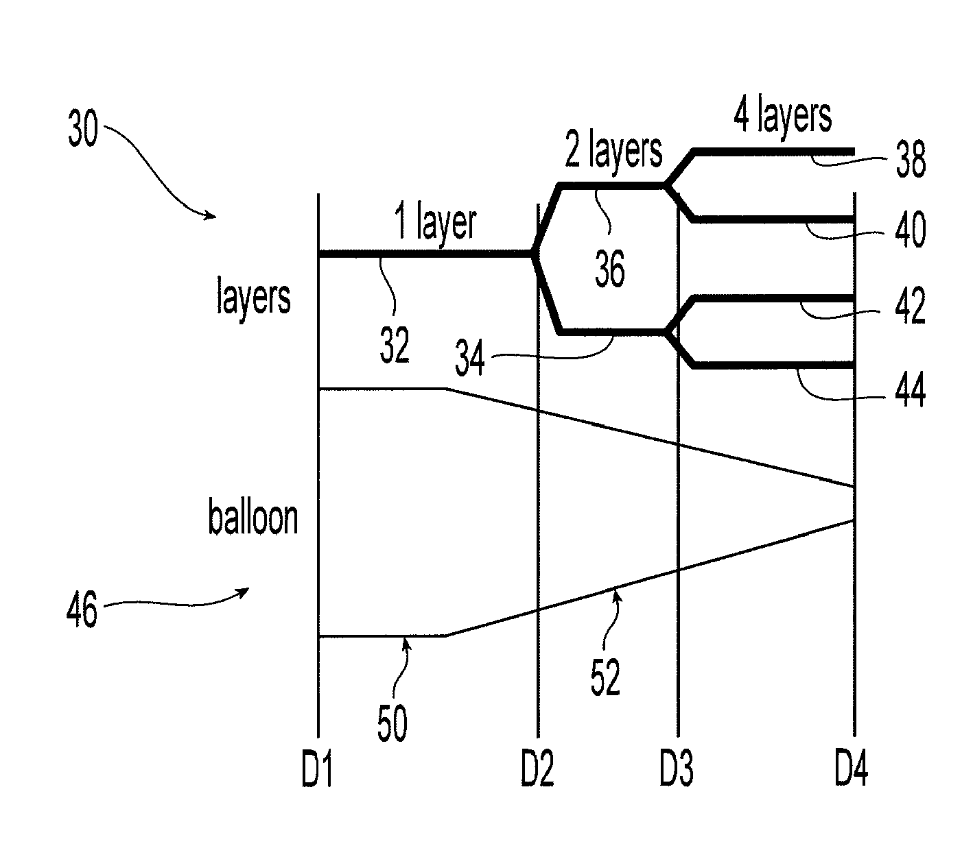 Balloon with dividing fabric layers and method for braiding over three-dimensional forms