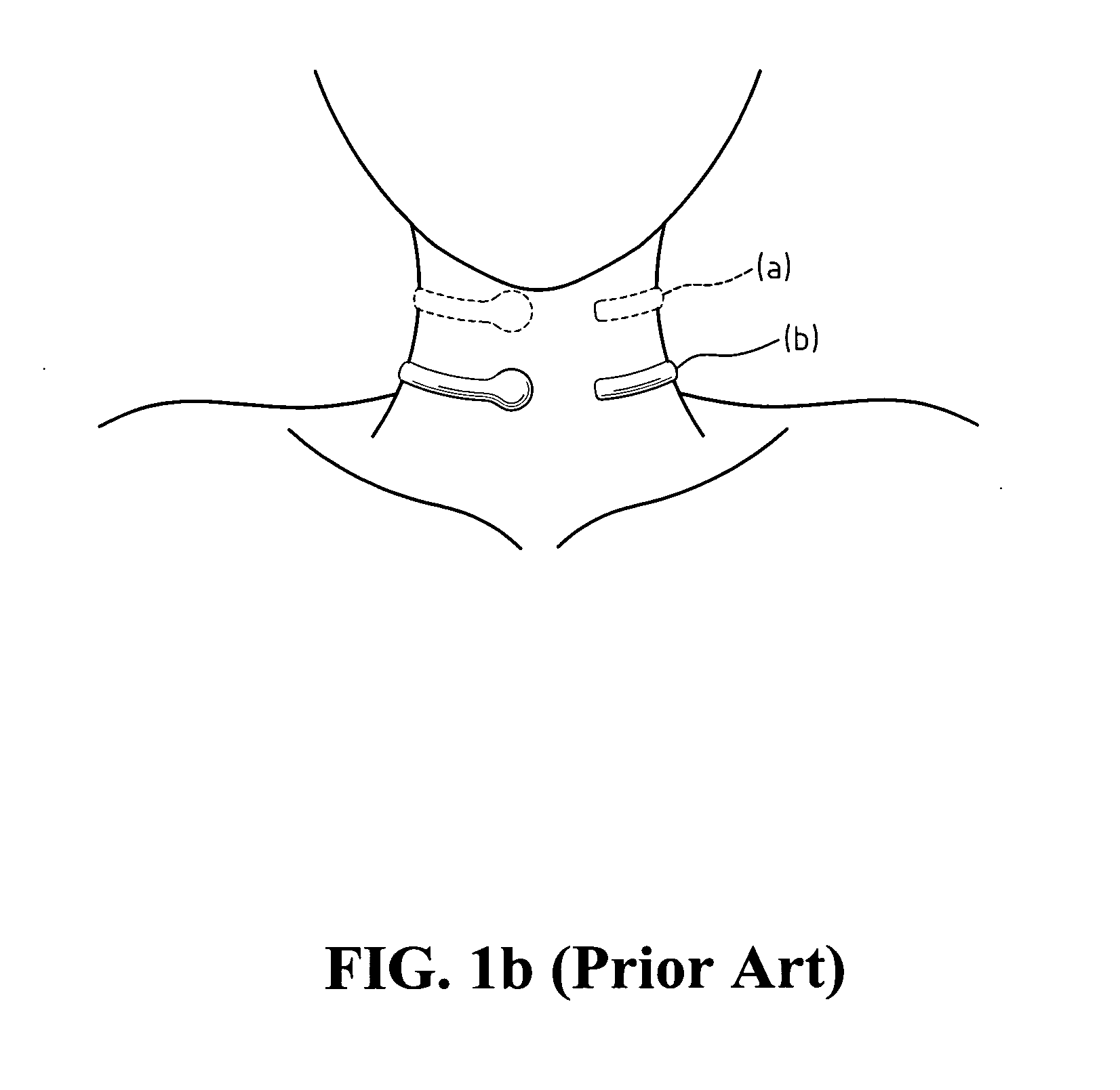 Three-dimensional skin-contact microphone device