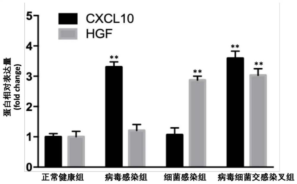 Application of combination of CXCL10 and HGF as pneumonia and infection source detection marker