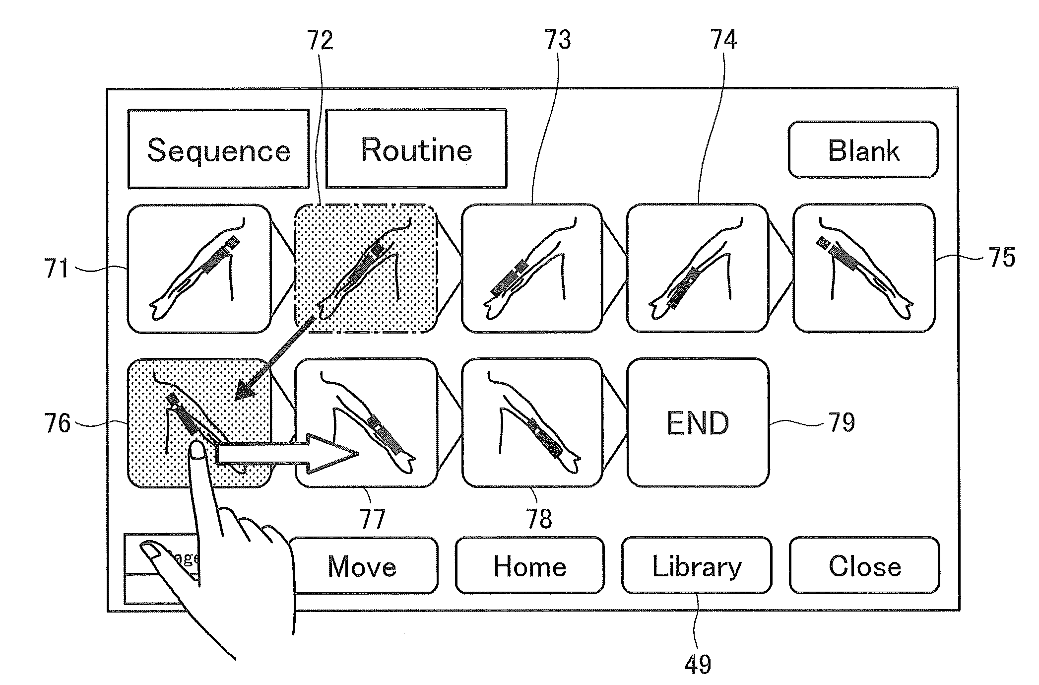 Ultrasound diagnostic apparatus