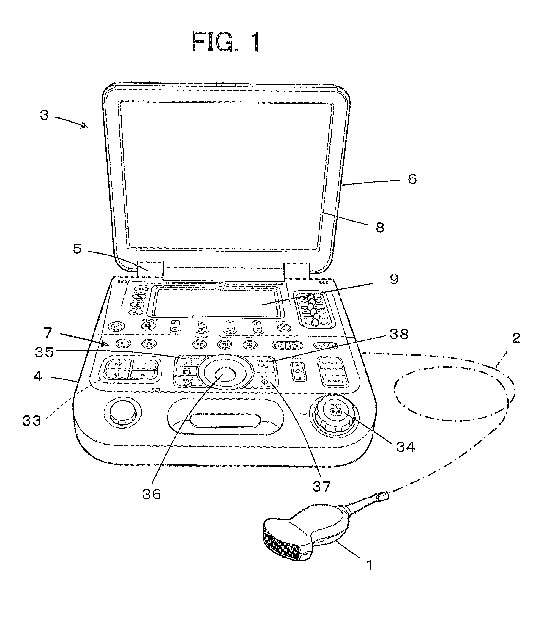 Ultrasound diagnostic apparatus