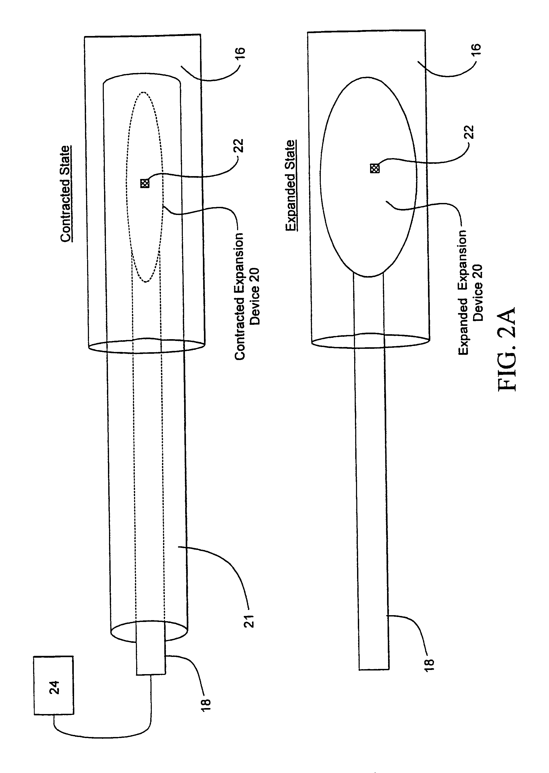 Sphincter treatment apparatus