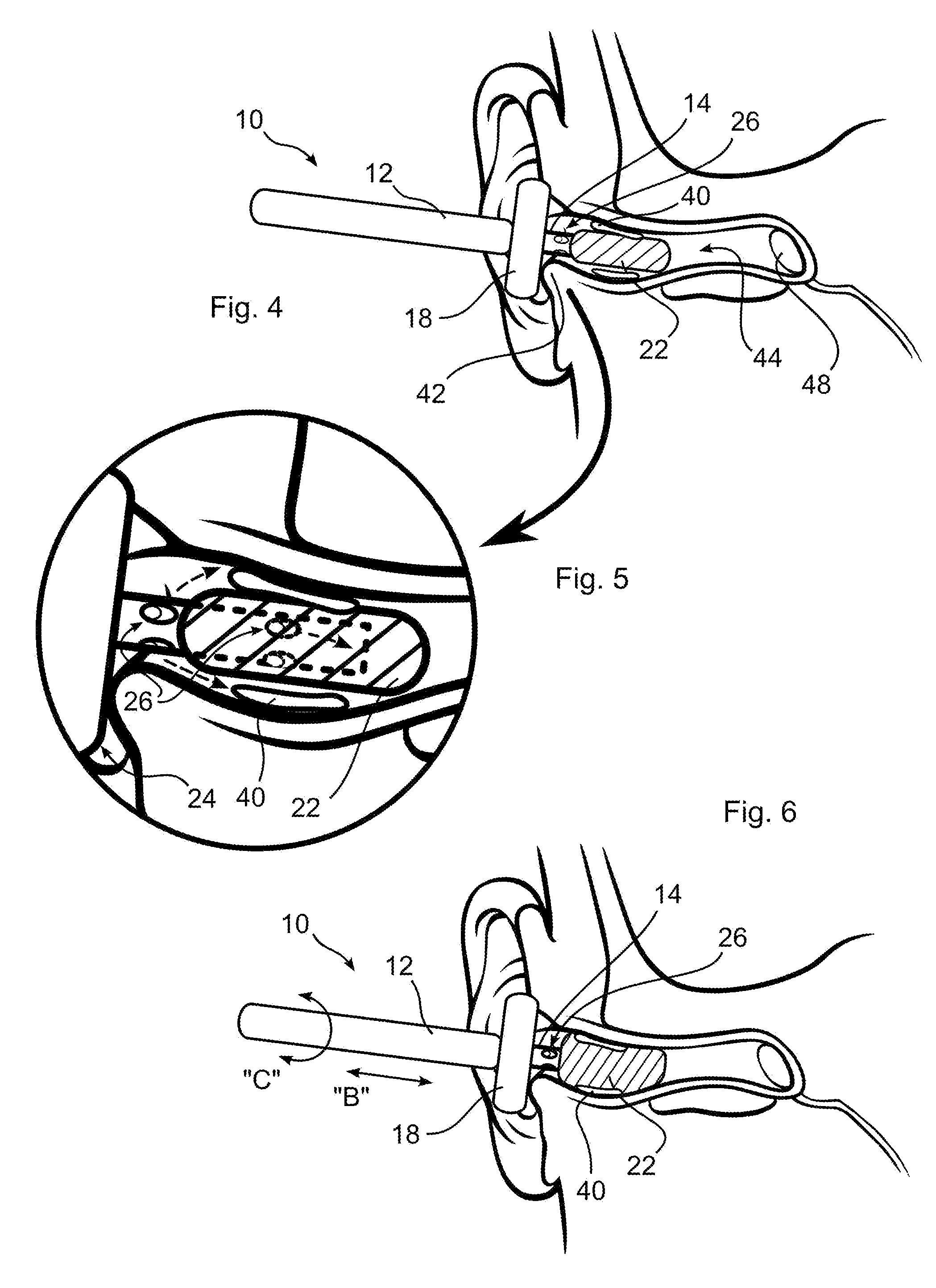 Ear cleaning system and method